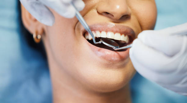 Best Walk-In Emergency Dental Services in Pismo Beach, CA
