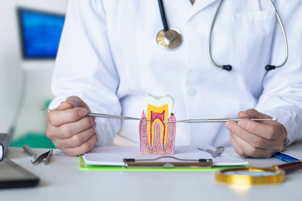 Best Knocked-Out Tooth (Avulsed Tooth) Treatment in Pismo Beach, CA